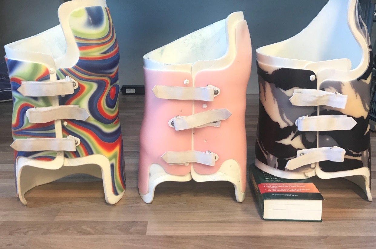 Patiëntverhaal Noor 2 Bewerkt