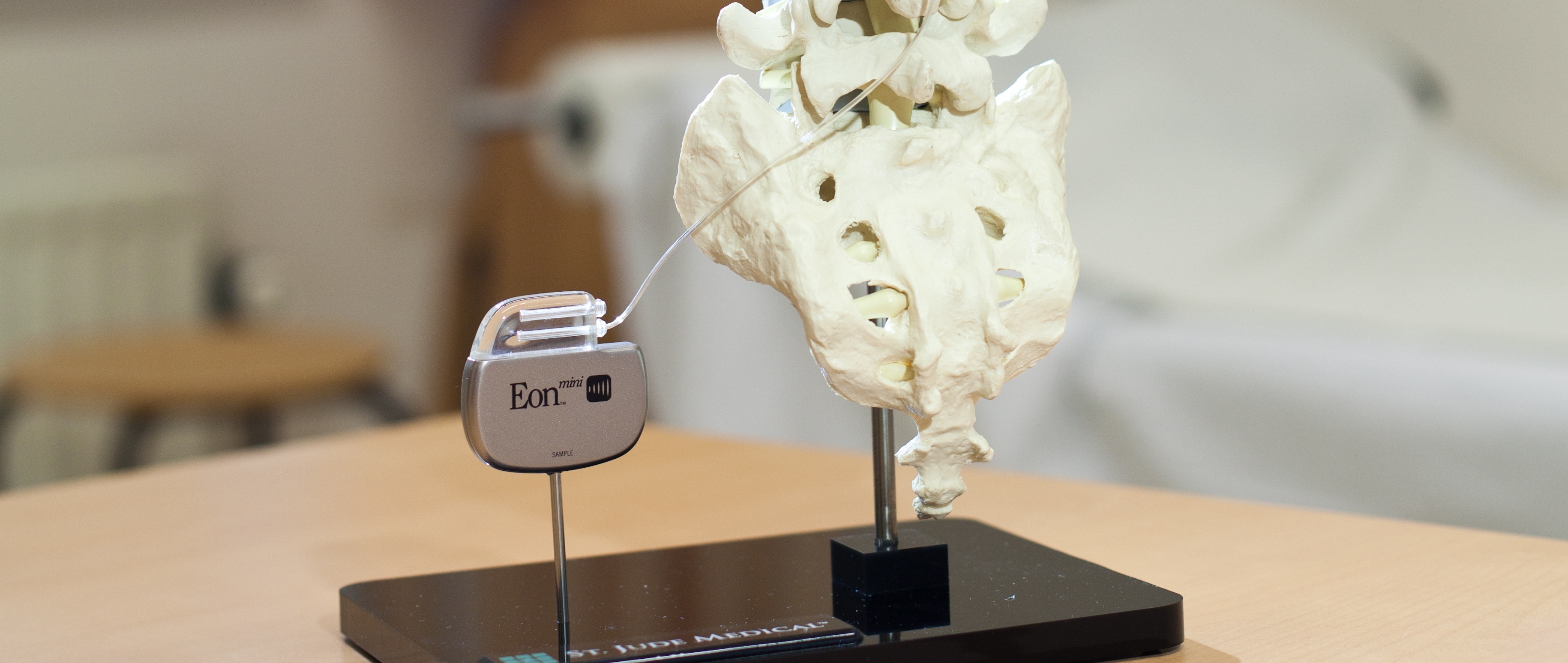 25 Het Apparaat Neuromodulator